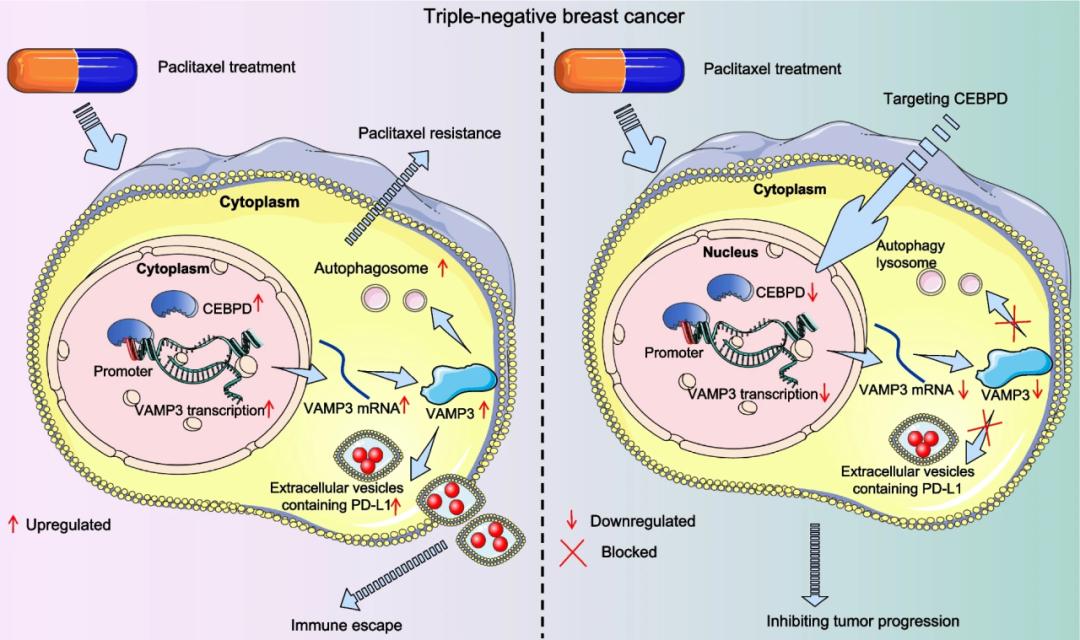 中国医科大学揭示克服三阴性乳腺癌治疗耐药性最新靶点