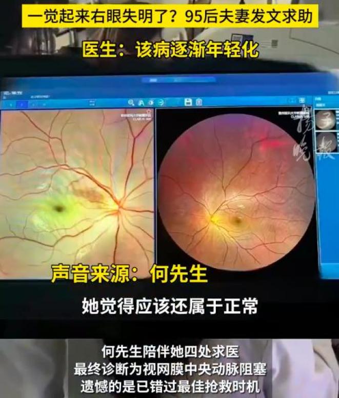 "95后"女子一觉醒来右眼失明!医生:已错过最佳抢救时机,警惕