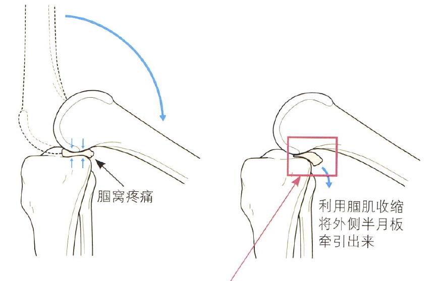 膝关节运动图图片