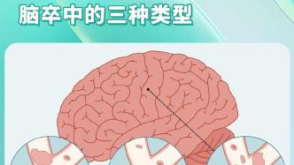 上海冬雷脑科医院的脑卒中急救指南，关键时刻能救命