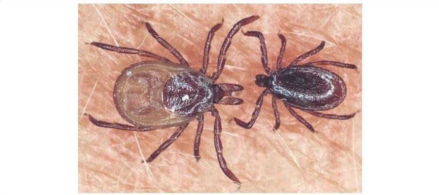 踏青之后,头发里怎么叮了个虫?