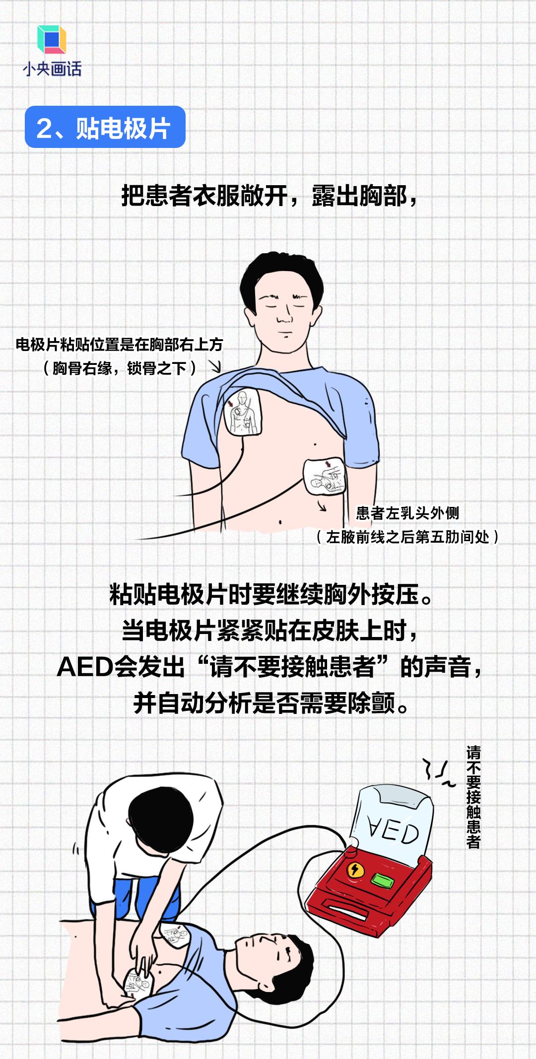 "救在身边"!江海区深入开展应急救护培训,推动aed配置完善