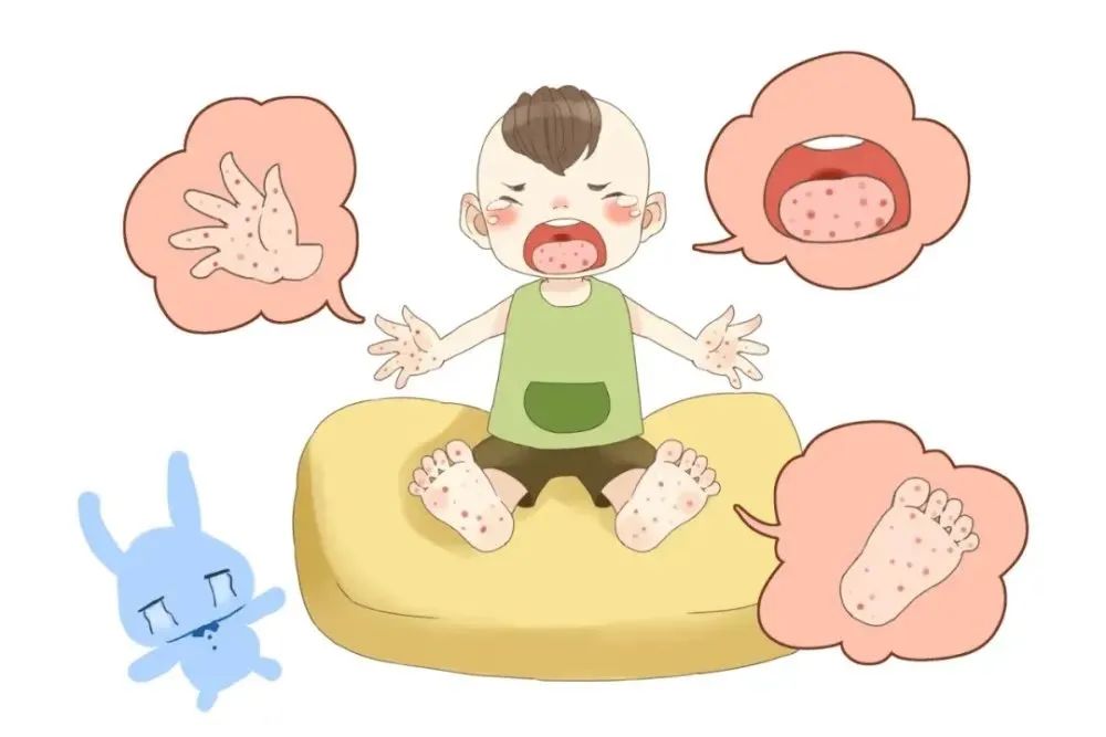 孩子哭闹,可能是得了手足口病丨贤医健康说_澎湃号·_