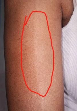 (图源小红书,腹部虾线?)(图源文献5,有点像纹身?