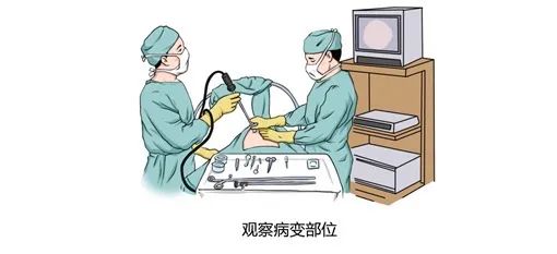 乳房手术无疤痕——九亭医院成功开展首例经腋窝腔镜单孔乳房肿瘤切除