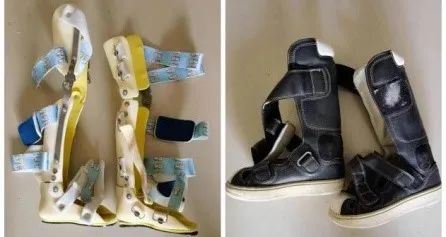 "活不过20岁"的恐惧会伴随着我,直到儿子生命的最后一刻