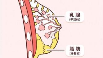 乳腺增生了，该怎么办？会否变成乳腺癌？