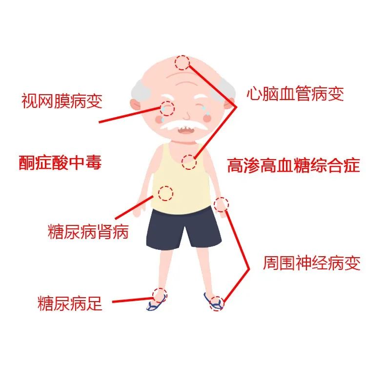 糖尿病并发症会导致图片