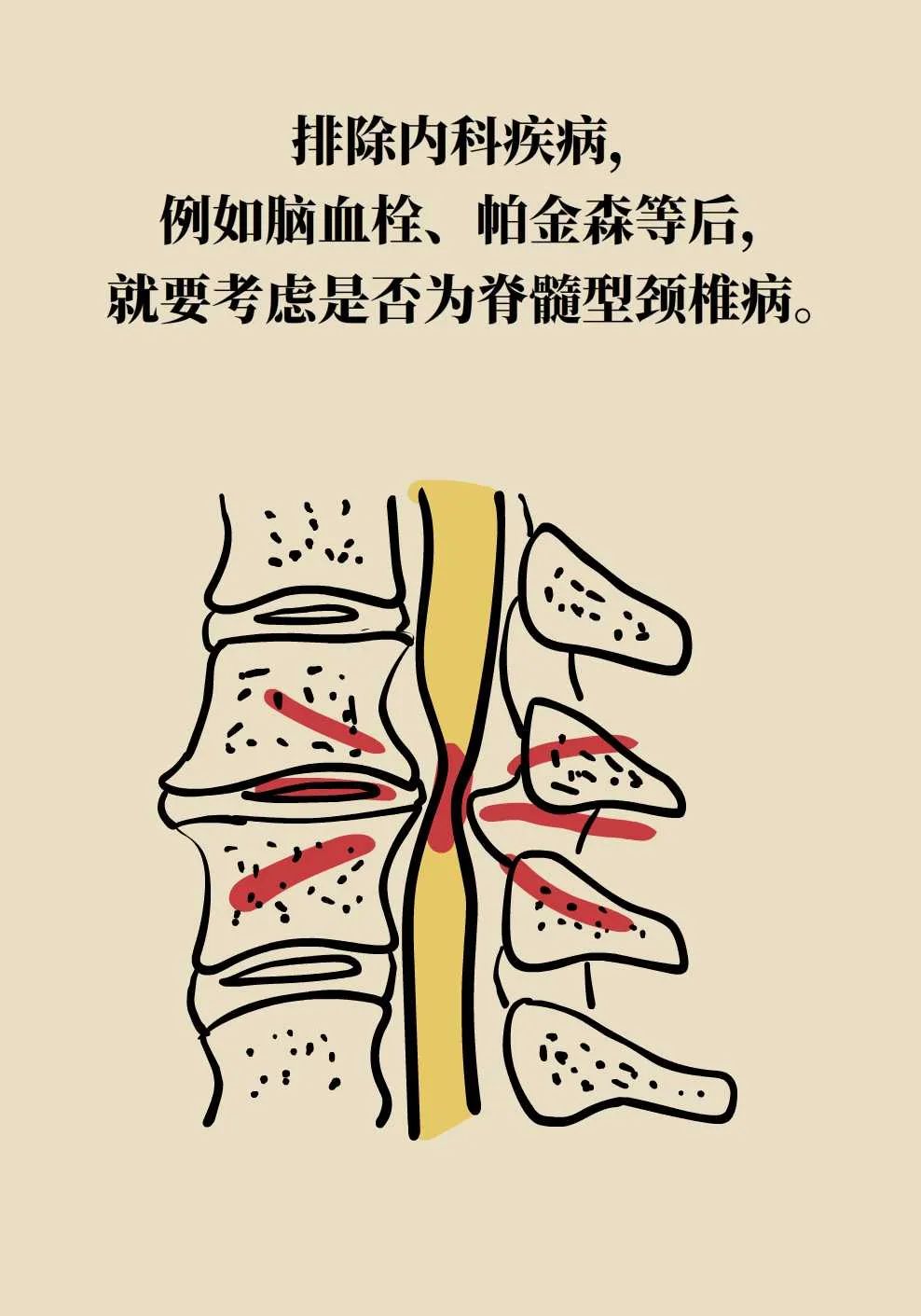 脖子疼就是颈椎病?这几个知识点记一下