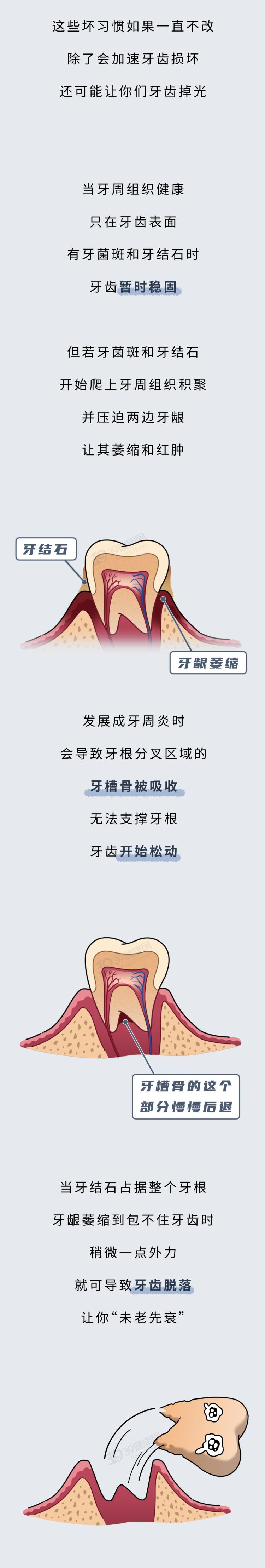 2,有龋齿的人群:可以