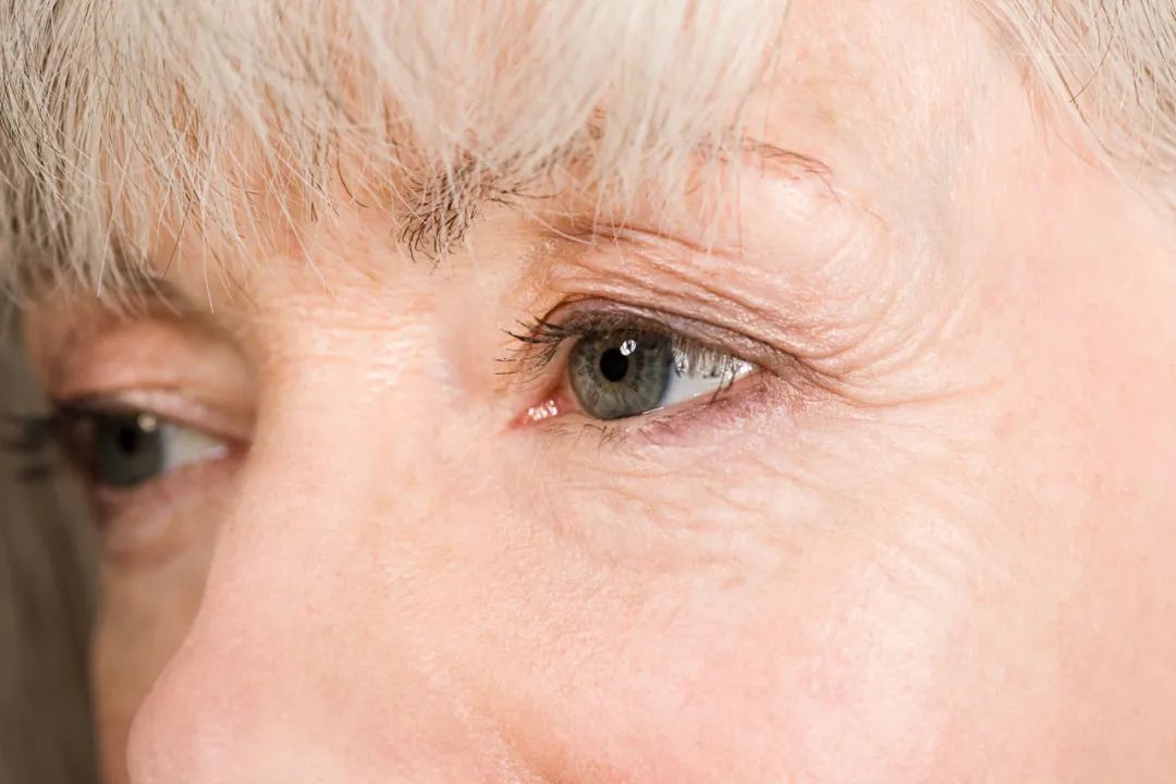 肝开窍于目,眼睛依赖肝阴的滋养,眼病是肝病的外在之象,肝和则目能辨