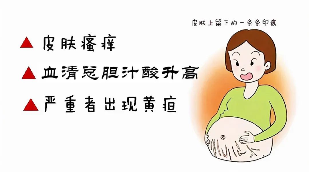 孕期胆汁淤积症图片