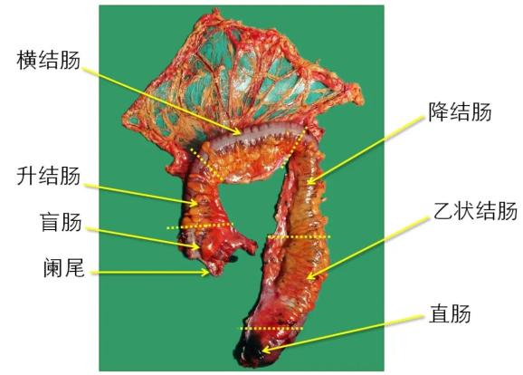 医学笔记︱结肠应用解剖的四个要点