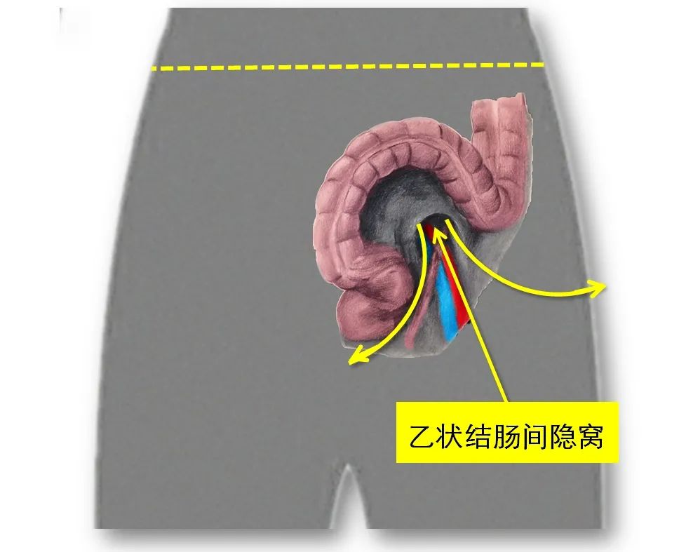 脾静脉走行图片