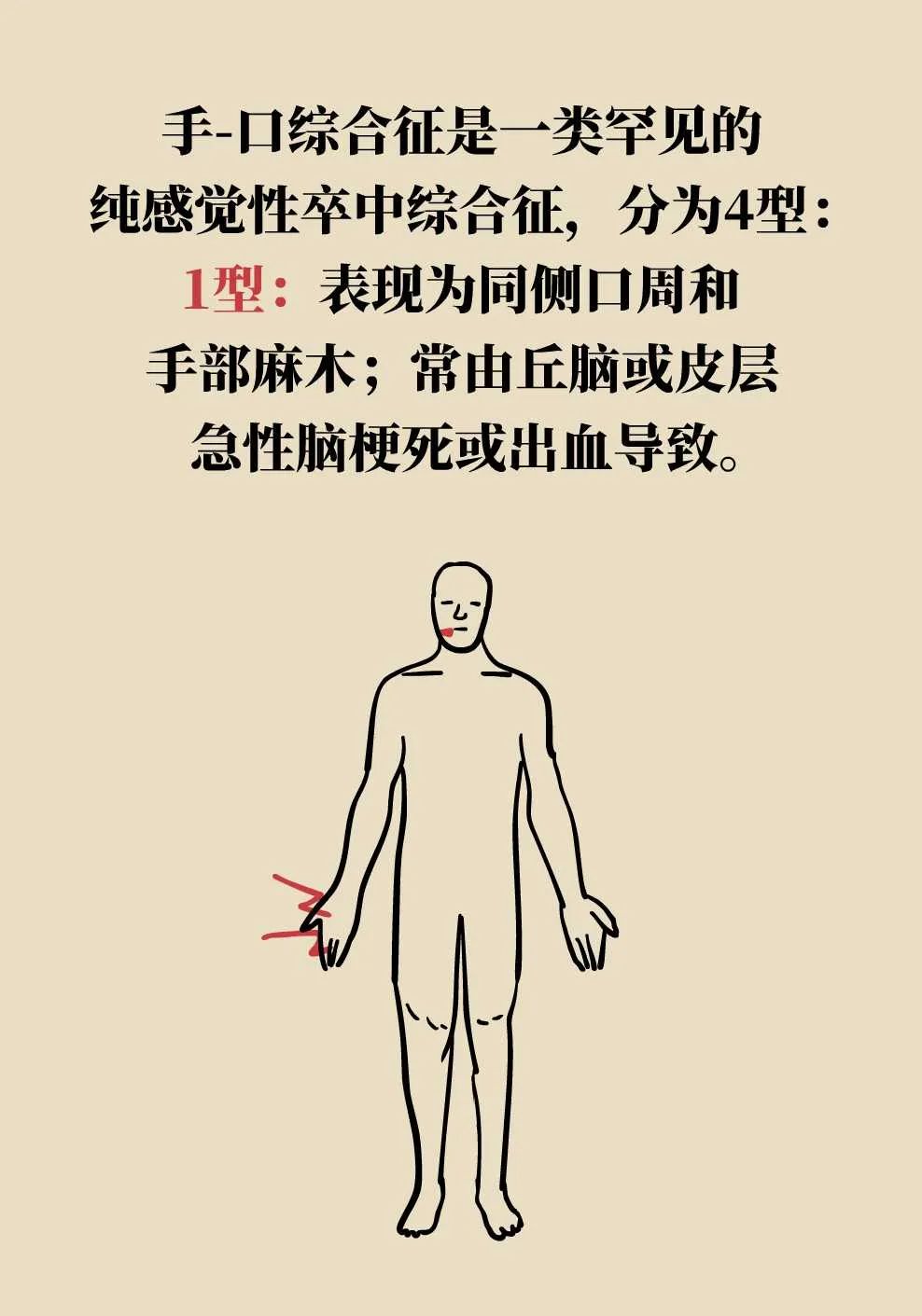 只是手和口麻木也可能是大病，要当心_澎湃号·湃客_澎湃新闻-The Paper