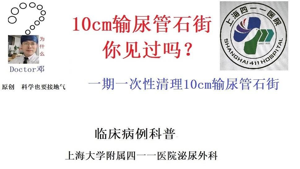 10cm输尿管石街，你见过吗？