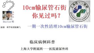 10cm输尿管石街，你见过吗？