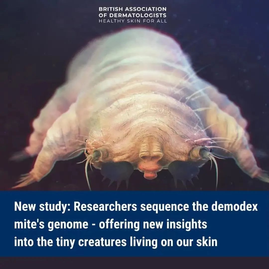 毛孔粗大是因为螨虫感染吗?有关毛囊蠕形螨的真相