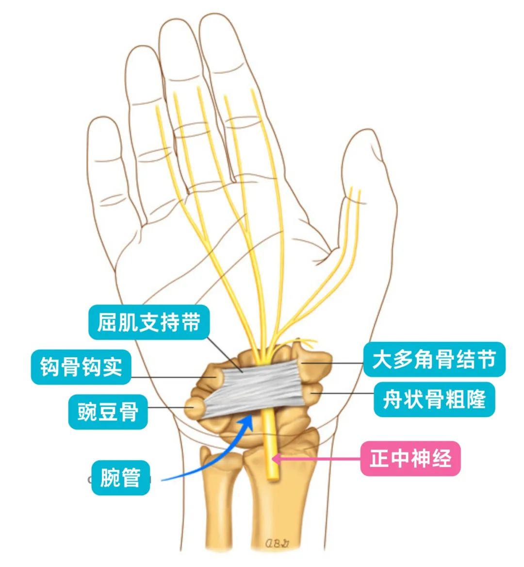 损伤,水肿,进而导致手指麻木,无力,疼痛甚至手掌肌肉萎缩的疾病[2]