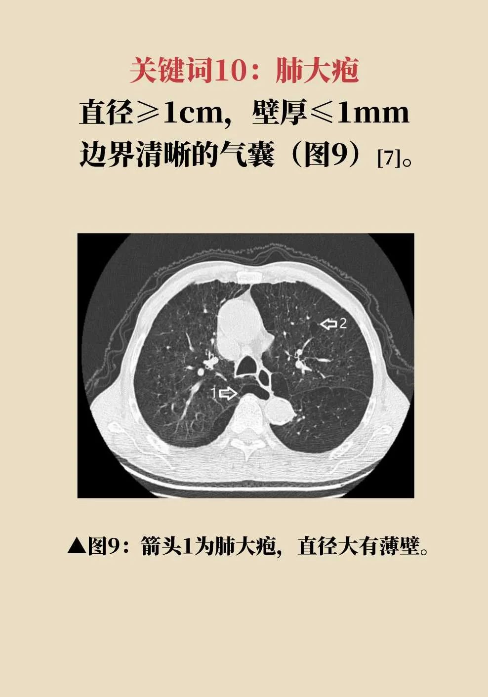 肺门ct图片