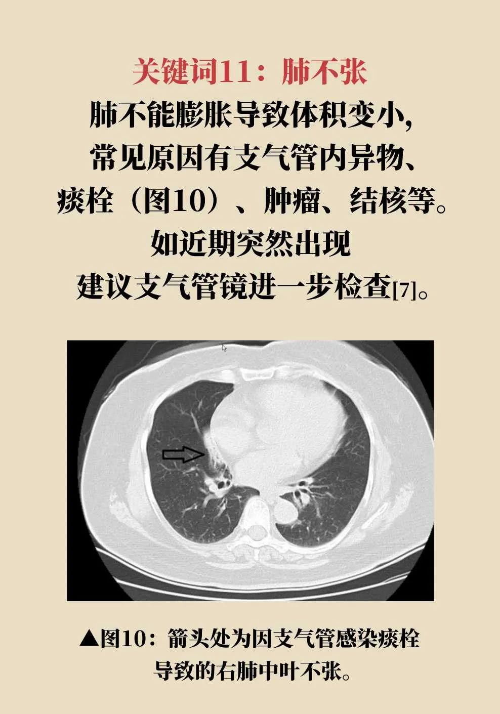 解密肺部ct报告的14个关键词