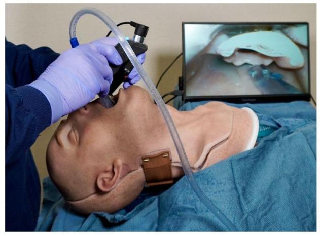 气管插管及紧急气道管理,"急诊干货"值得收藏