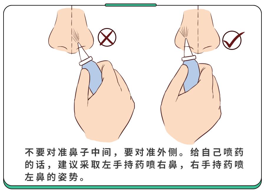 给过敏娃喷药的时候,也要注意姿势:过敏性鼻炎的娃尤其要注意,少接触