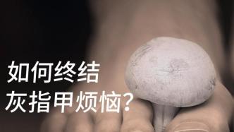 被灰指甲折磨多年，還有救嗎？