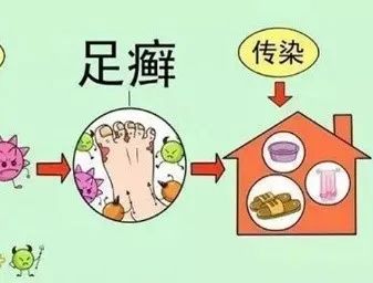 易传染 可引起足部的进一步瘙痒,糜烂,红肿,易传染身体其他部位.