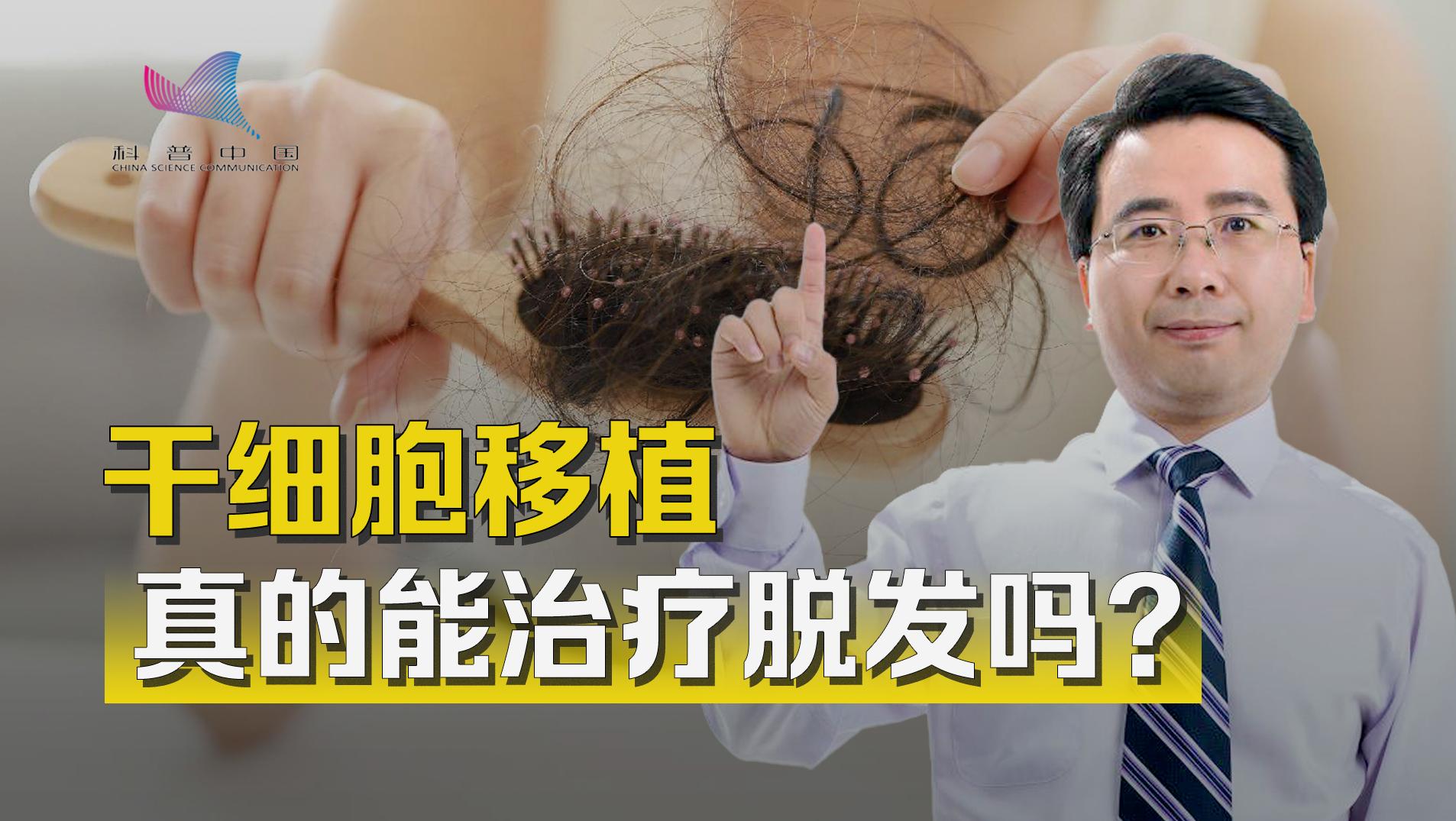 人为什么会脱发？中国脱发人群越来越年轻，干细胞移植须谨慎