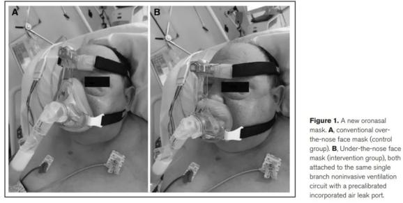 无创面罩怎么带比较鼻下面罩和口鼻面罩在治疗急性高碳酸血症性呼吸衰竭中预防面部压力性损伤的效果评价_https://www.jmylbn.com_新闻资讯_第2张