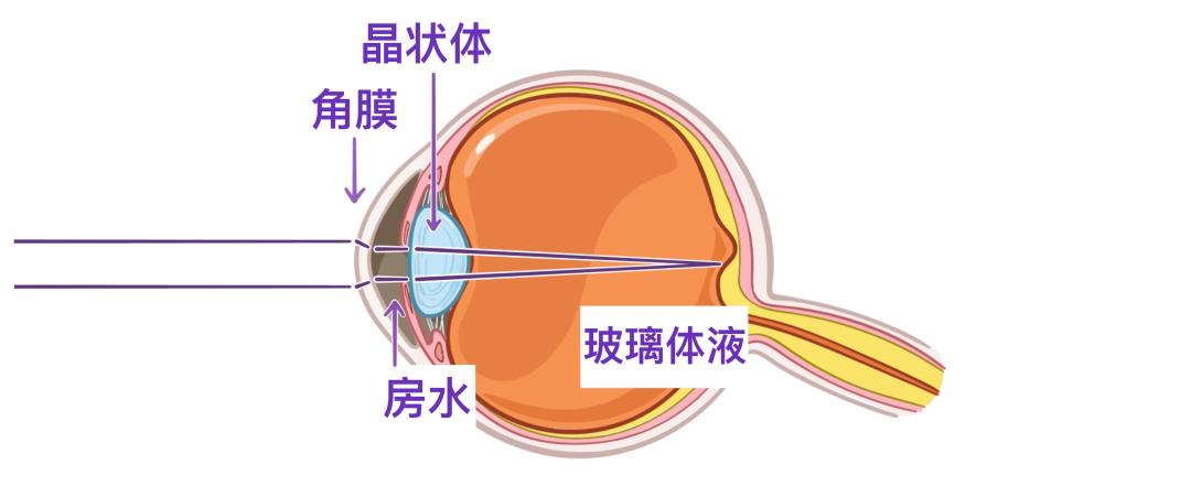 眼睛前房是哪里示意图图片