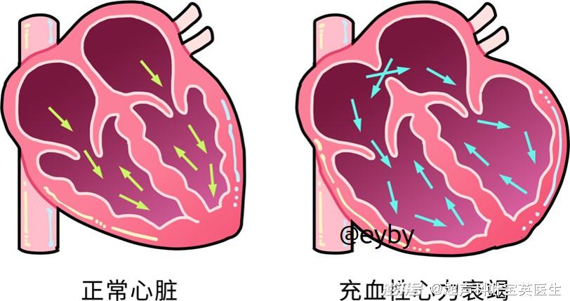 妊娠合并有房间隔缺损,超声来护航助孕妈房缺早知晓