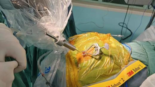 神经外科手术机器人的机械臂和探针方案获得成成一家人的高度认可,成