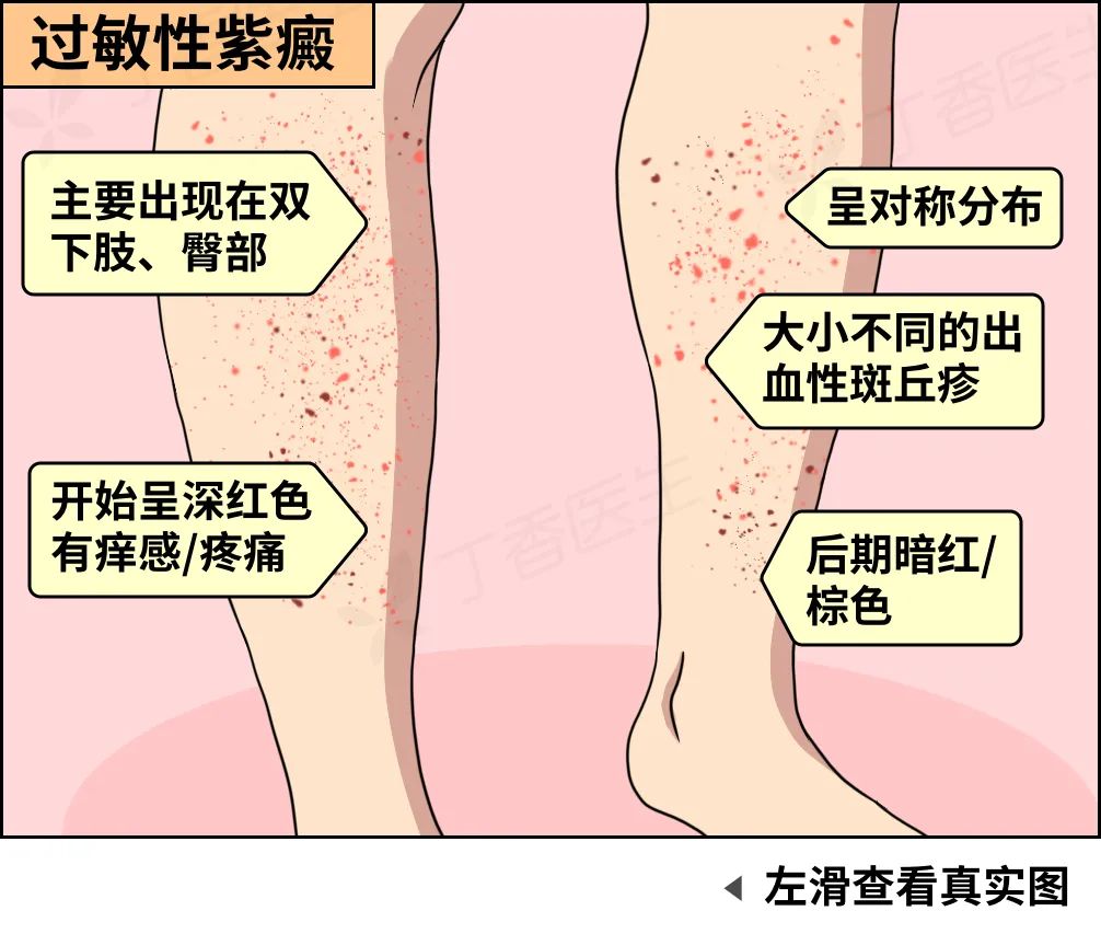 身上突然冒出来的小红点,到底是啥啊?