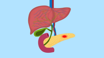 深入了解胆源性胰腺炎，守护您的胰腺健康