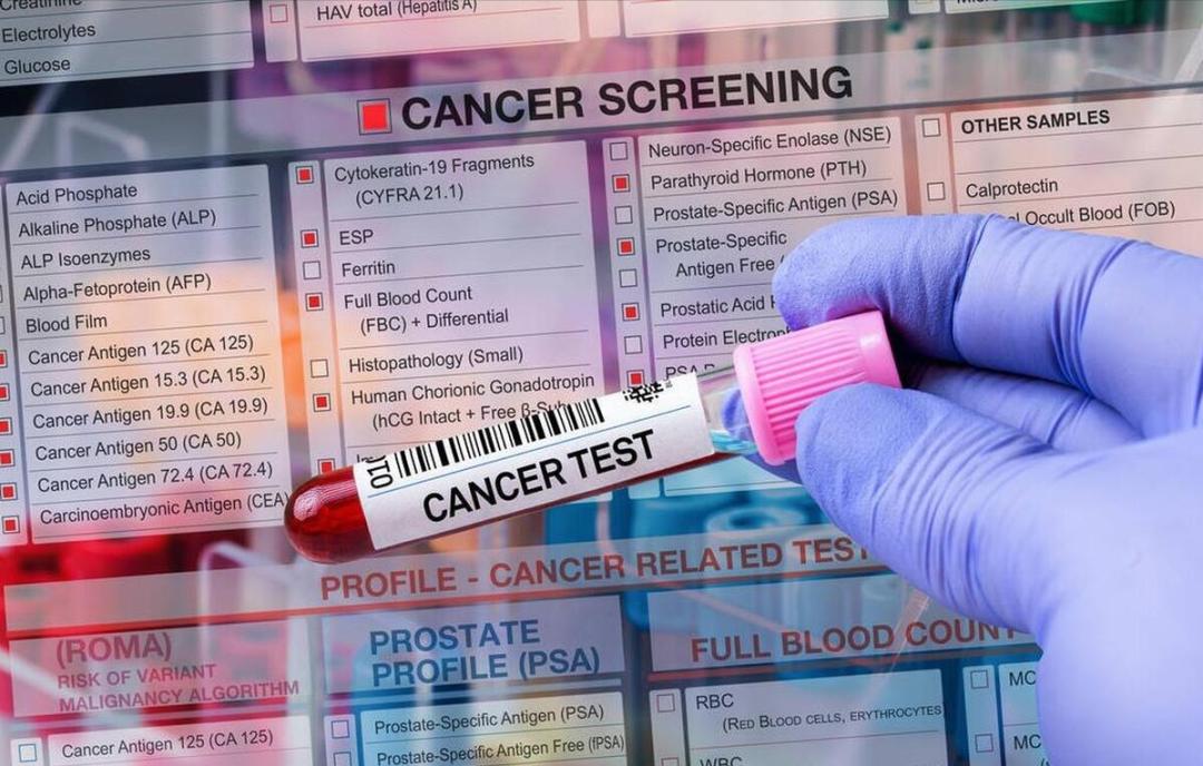 乳腺红外线检测什么体检不要轻易碰这5个项目_https://www.jmylbn.com_新闻资讯_第1张