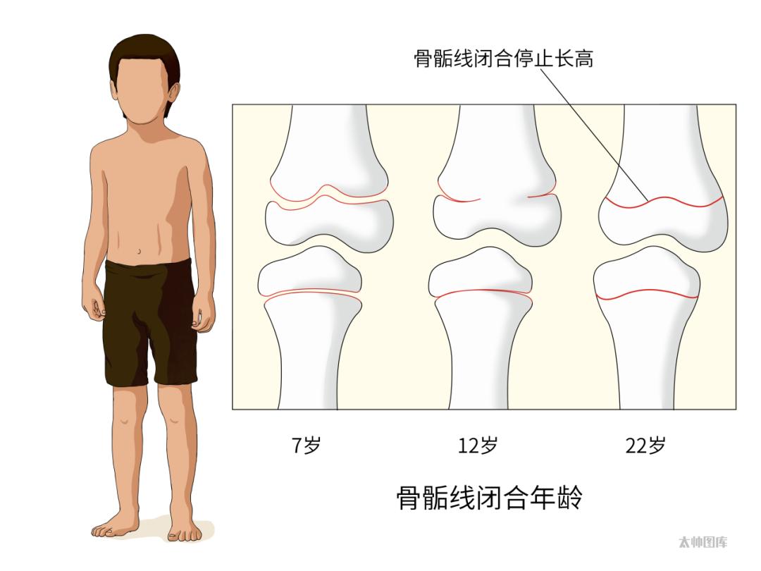 图片/太帅图库女孩一般闭合时间会比较早,一般12~16岁左右,有的14岁