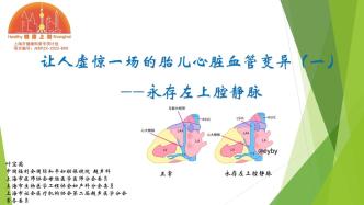 讓人虛驚一場的胎兒心臟血管變異：永存左上腔靜脈?