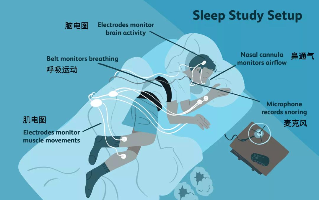 测量睡眠的金标准是多导睡眠监测,"多导"指同时测量多种信号,包括脑电