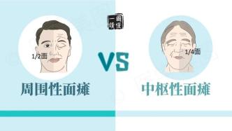 一圖讀懂丨周圍性面癱 VS 中樞性面癱