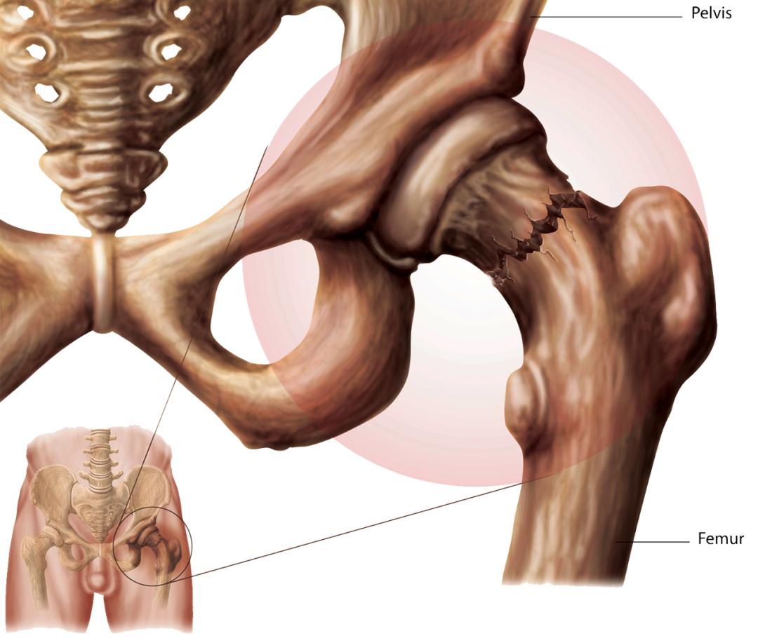 股骨头韧带 澎拜新闻