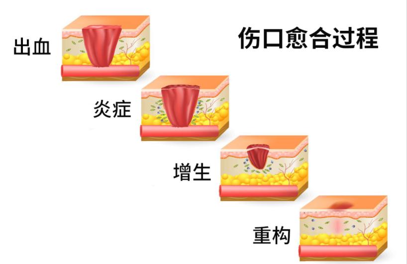 科普解颐丨伤痕累累？揭秘皮肤的“重生”之旅  第2张