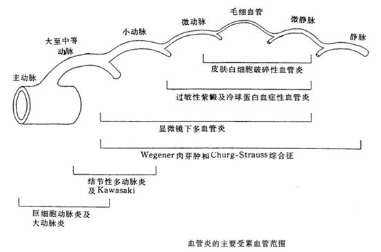 血管炎挂号挂什么科好(血管炎挂号挂什么科好的快)