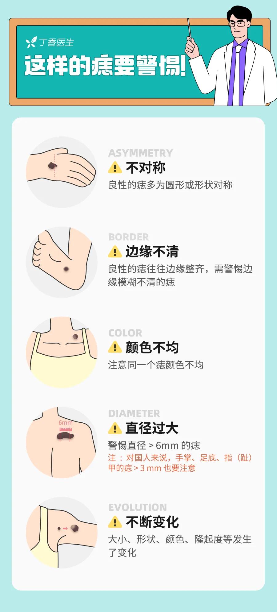 有 5 种痣要注意