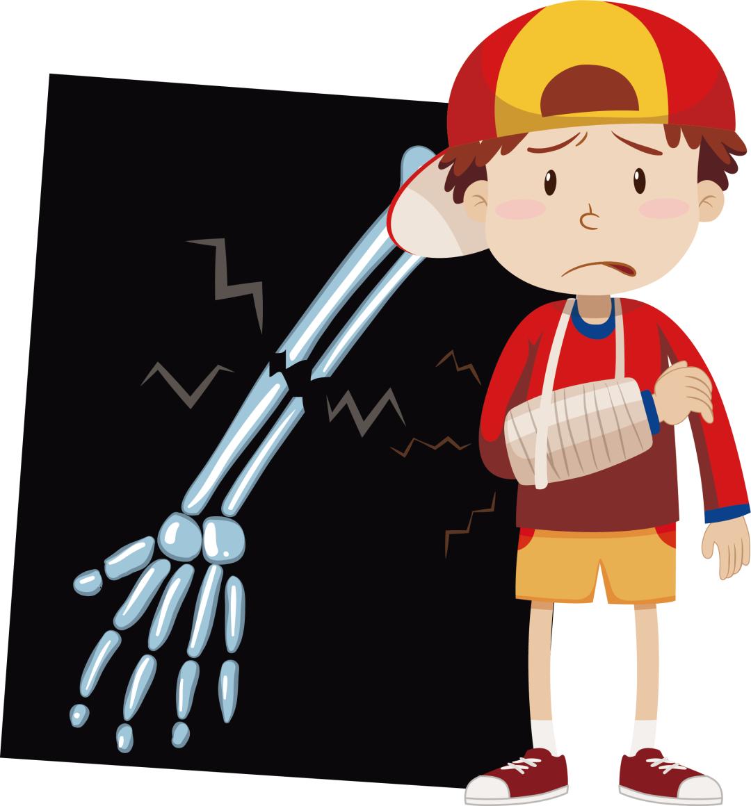 儿童骨折后打石膏时间长,会导致关节僵硬?