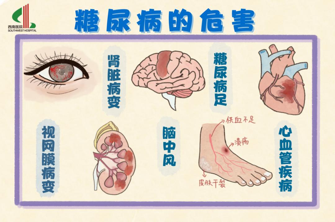 蛋白质代谢异常,心血管疾病,视网膜病变,肾脏病变,糖尿病神经病变,脑