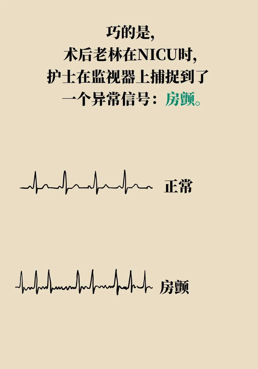 老人连续多次中风，真的有“中风体质”吗？  第18张