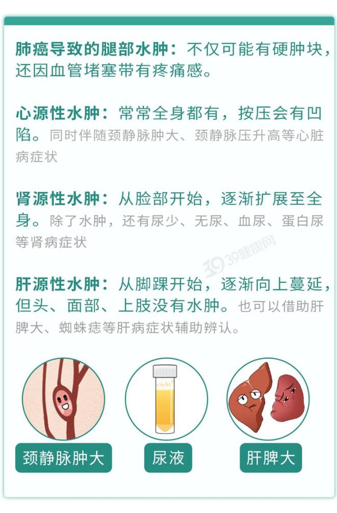 双腿出现这3个症状,千万要重视!