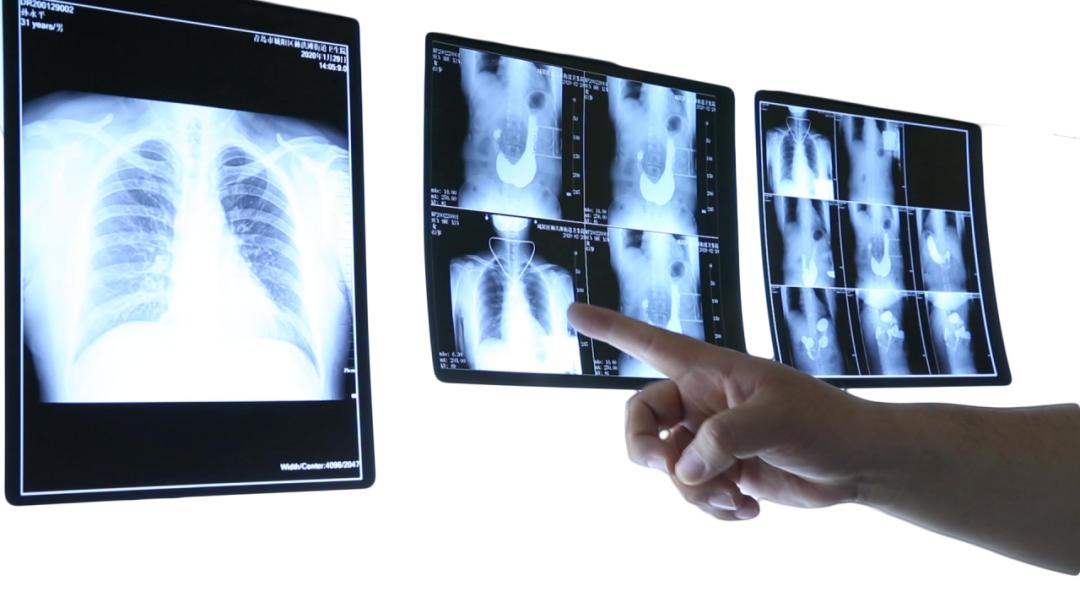 取片机怎么用医路畅通｜取片不用跑，云胶片“码”上可见！普陀区中心医院进入“云胶片”时代_https://www.jmylbn.com_新闻资讯_第1张